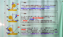 Ⅰa・Ⅰb抑制など